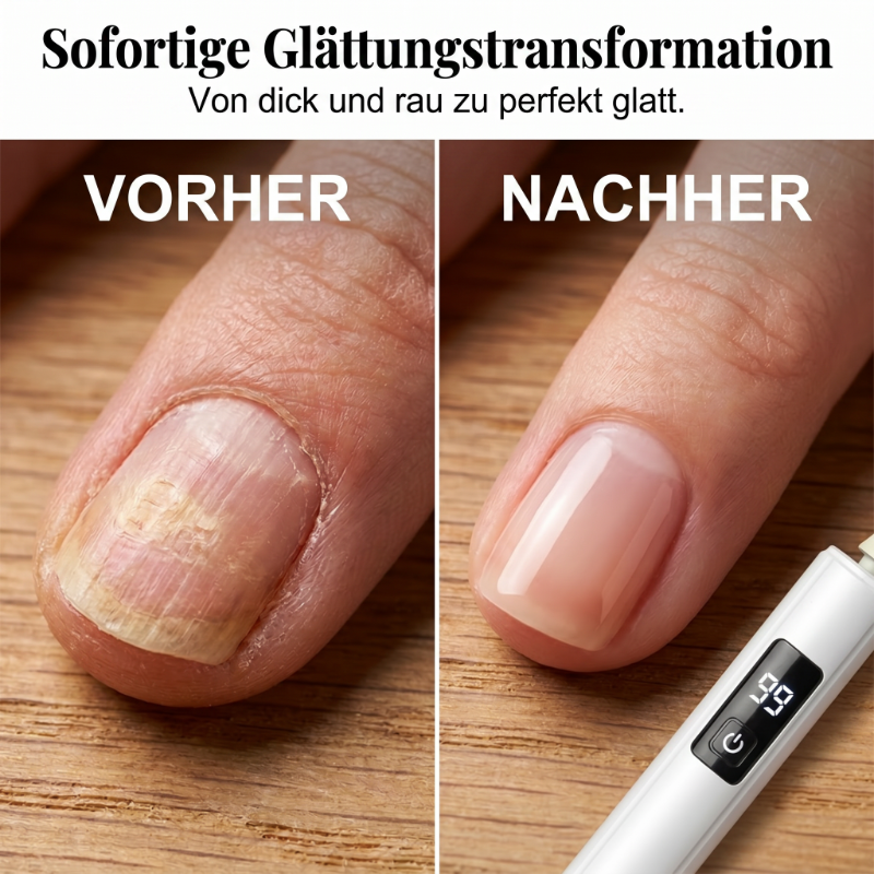 NagelPerfekt™ - Elektrisches Profi-Nagelfräser-Set