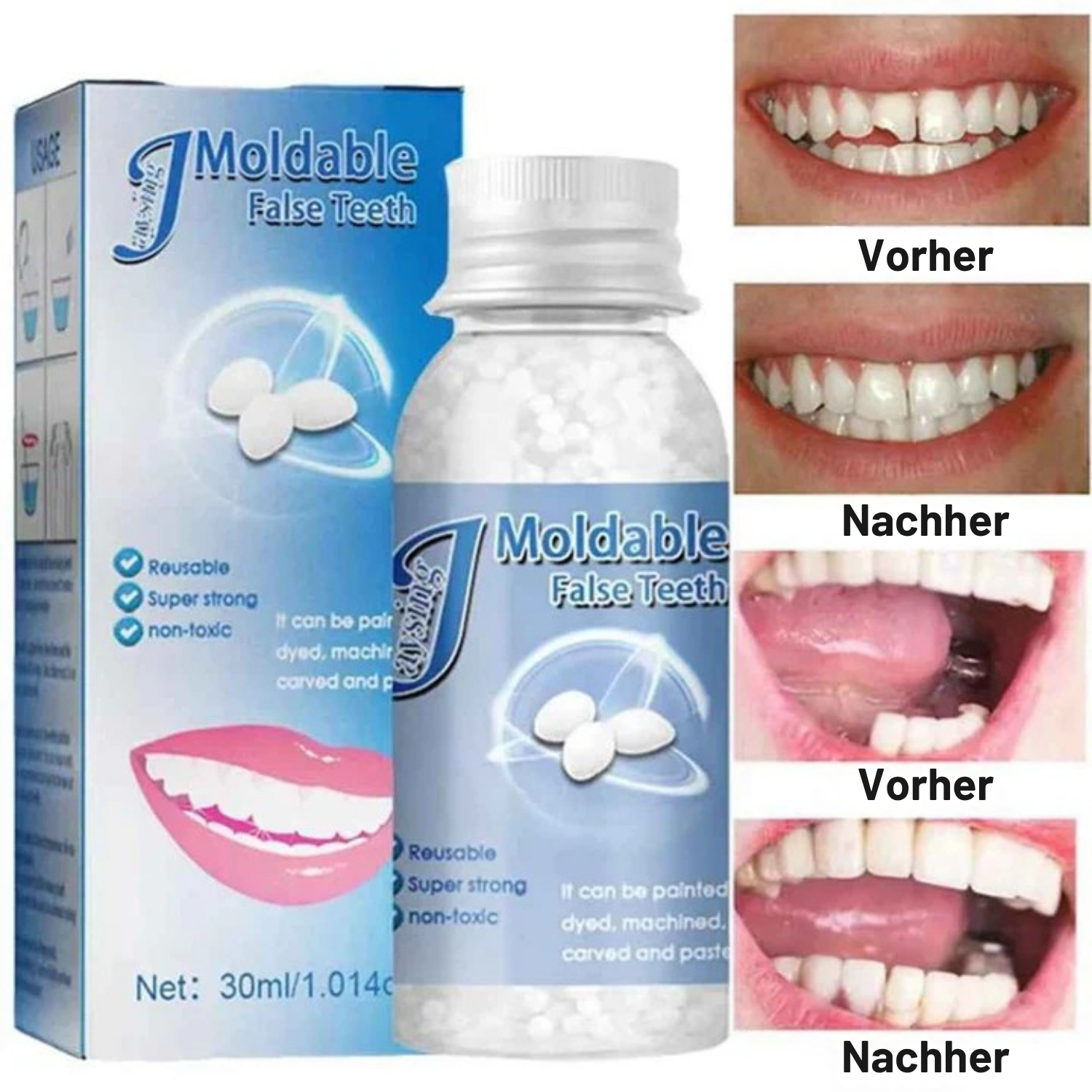 SmileFix™ - Natürlich Aussehendes Zahne Reparaturset (1+1 Gratis)